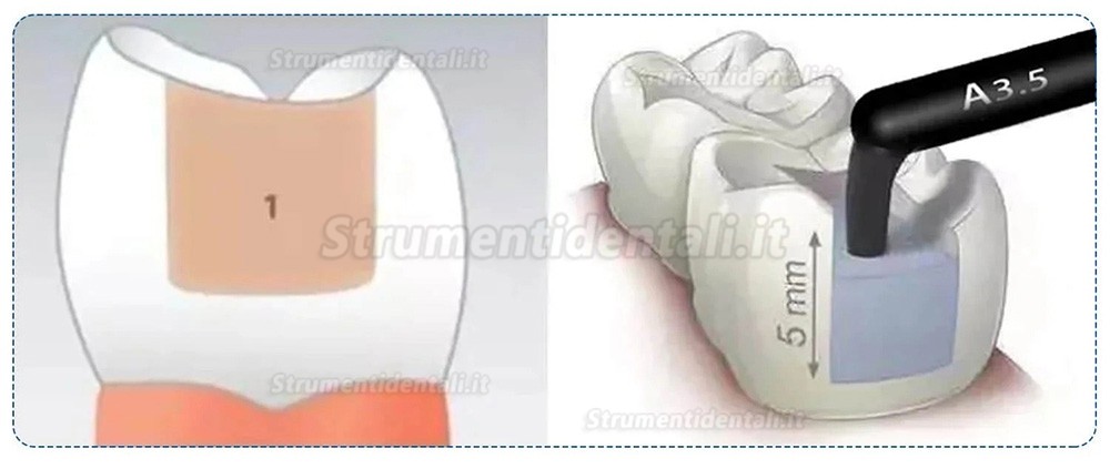 10 capsule/scatola di resina composita dentale fotopolimerizzabile A1/A2/A3/A3.5